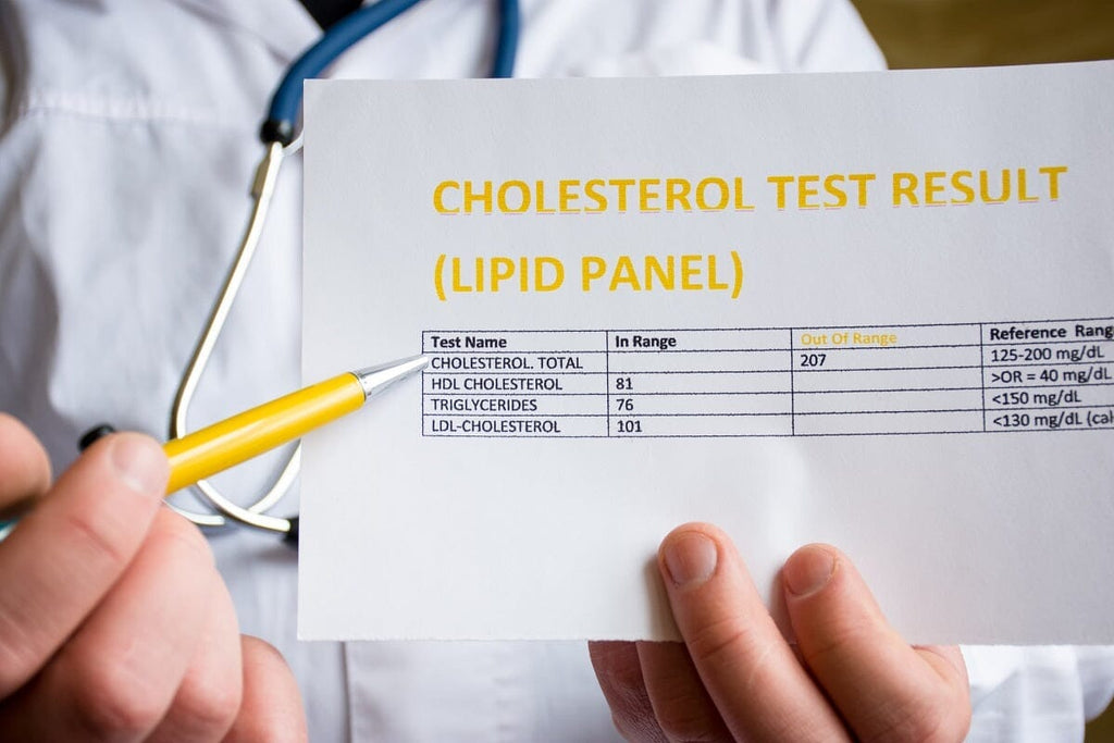 Fasting vs Non-Fasting Lipid Profile Tests: A Complete Comparison ...