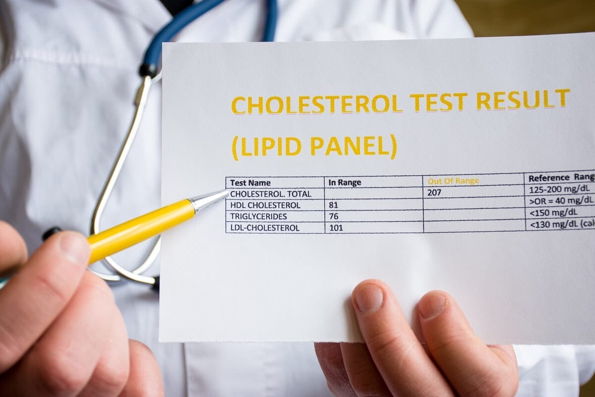 Fasting vs. Non-Fasting Lipid Profile Test: Which Is More Accurate?