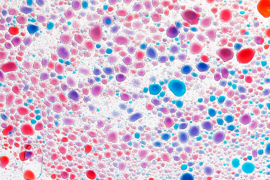 Epithelial Cells in Urine: Understanding Ranges and What They Indicate