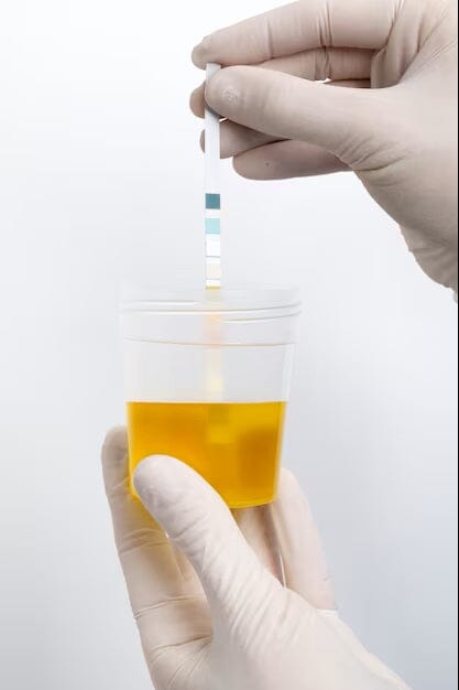 Understanding the Stool Routine Test: Purpose, Process, and Results ...