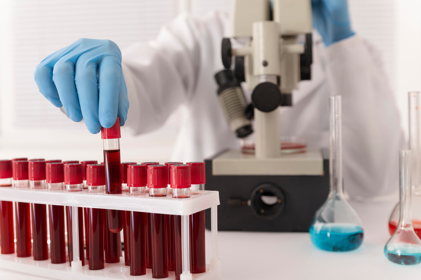 Activated Partial Thromboplastin Time | Blood Tests | Understanding APTT  | Bleeding Disorder |