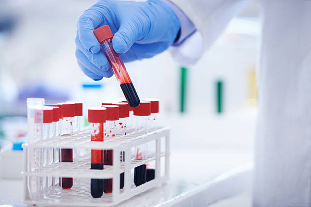 Packed Cell volume | Complete Blood Count | Red Blood Cells