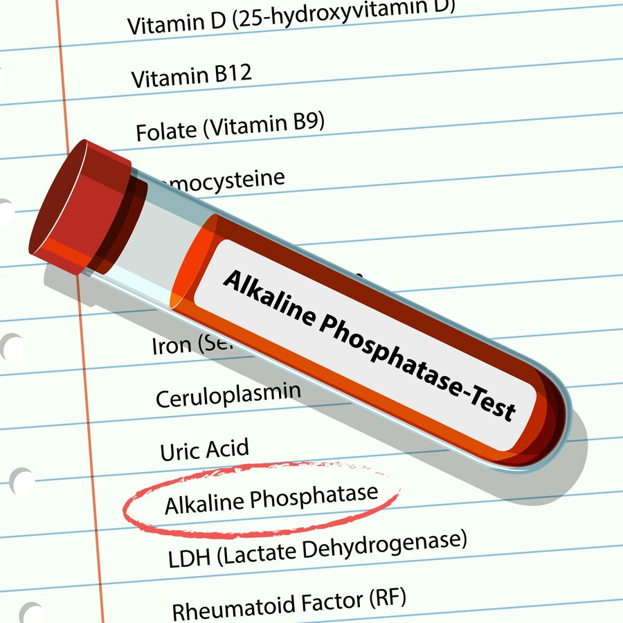 Alkaline Phosphatase (ALP): What It Means, Normal Ranges, and When to ...