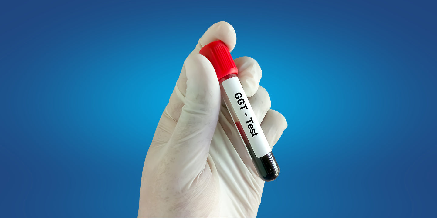 GGT Test: Understanding Gamma-Glutamyl Transferase and What High Levels Mean