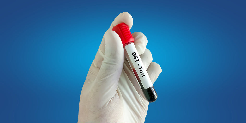 GGT Test: Understanding Gamma-Glutamyl Transferase and What High Levels ...