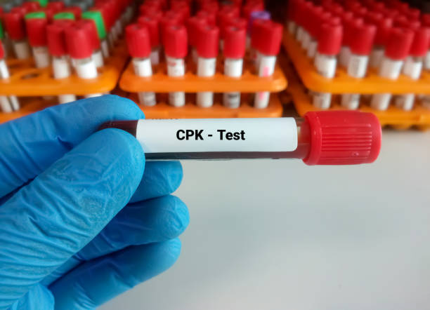 CPK Test | Creatine Kinase | Skeletal Muscle |  Creatine Phosphokinase Test 