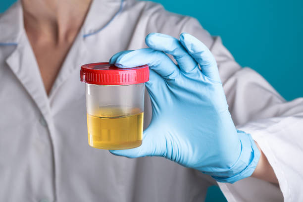 Urine Routine Test | Urine Test Normal values | Clean catch Method |  Urine Analysis | Urine Test Report | 