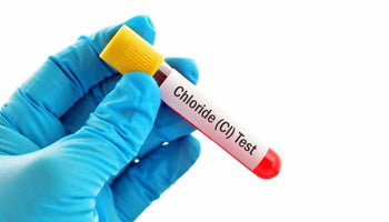 Chloride in Blood: Normal Levels, High Chloride, and Cl Tests Explained