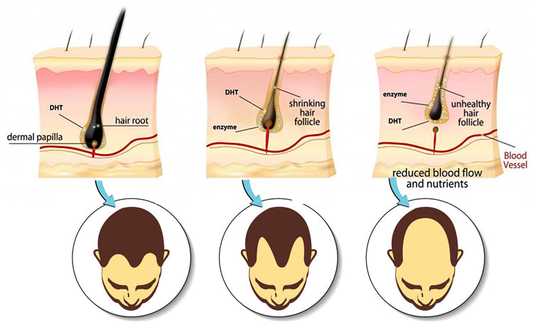 Top DHT Blocker Food for Healthy Hair Growth