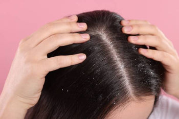 How to Get Rid of Dandruff & Dry Scalp: Home Remedies, Treatments and Prevention