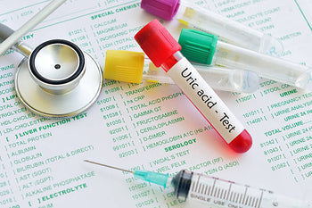 What is the Normal Uric Acid Level? Causes, Symptoms & More