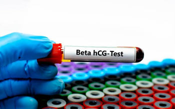 Beta hCG Test: Normal Levels, Ranges & How to Read Results