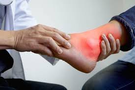 How to Reduce Uric Acid Naturally at Home: Foods, Remedies & Diet Tips
