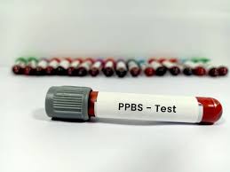 The Complete Guide to Postprandial Blood Sugar (PPBS) Test: Everything You Need to Know