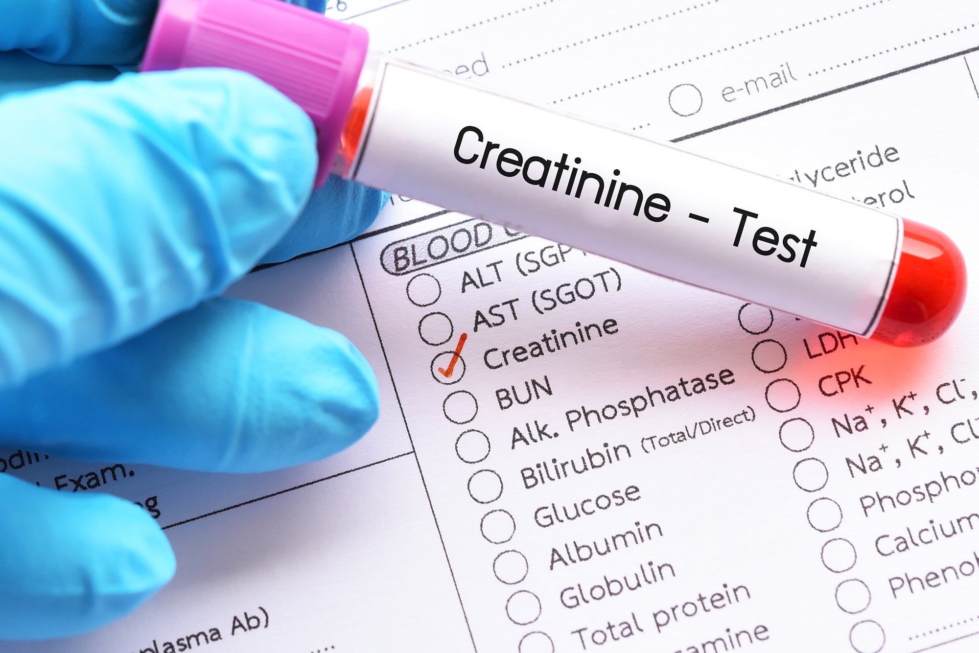 Creatinine Clearance — Test, Meaning, Normal Ranges & Kidney Function ...