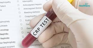 C-Reactive Protein (CRP) Test: Normal Range, High Levels, Causes, and Treatment