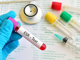 Erythrocyte Sedimentation Rate (ESR) Test: Normal Range, High Levels, Causes, and Treatment
