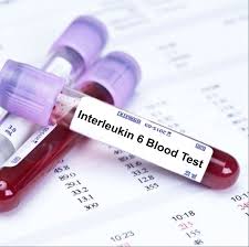 Interleukin-6 (IL-6) Test: Normal Range, Functions, and What High Levels Mean