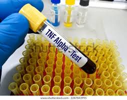 TNF-Alpha (Tumor Necrosis Factor): Functions, Test, Normal Range, and Role in Inflammation