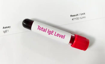IgE vs IgG Allergy Testing