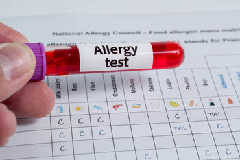 How to Read and Interpret Food Allergy Test Results