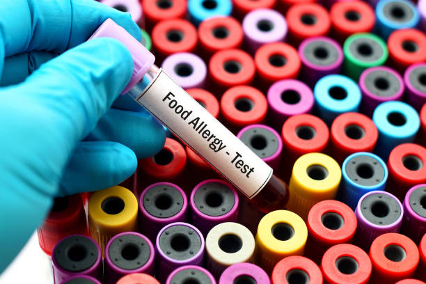 Skin Test vs Blood Test for Food Allergies