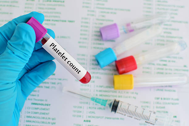 Immature Platelet Fraction (IPF) Test: Normal Range, High & Low Levels Explained