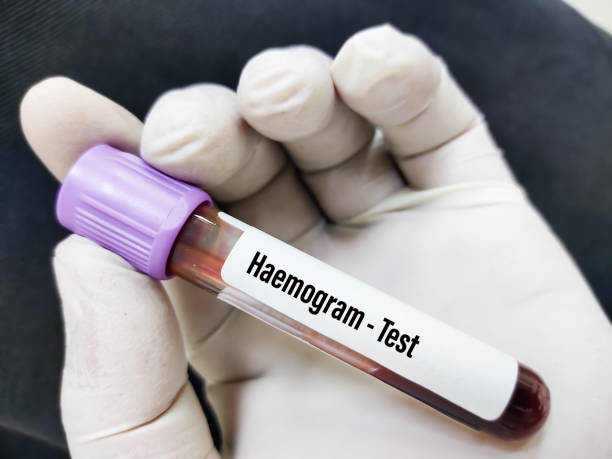 Haemogram Graph Hemogram Test (CBC & ESR): Meaning, Normal Range, & Price – MyDiagnostics