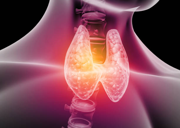 Hypothyroidism vs Hyperthyroidism 