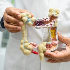 Gut Microbiome Test vs Stool Test: Which Is Better for Gut Imbalance & Dysbiosis?
