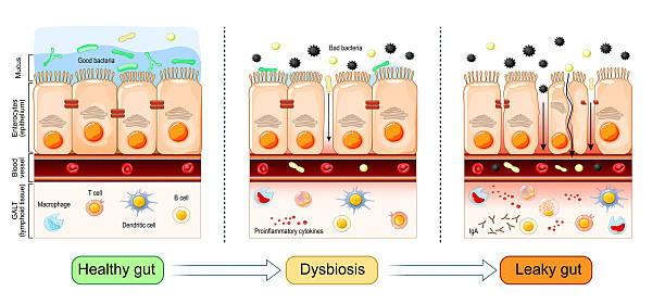 Gut Dysbiosis