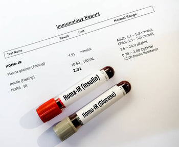 HOMA-IR Test | HOMA-IR Test: Cost, Normal Range, Procedure & Insulin Resistance Testing Guide
