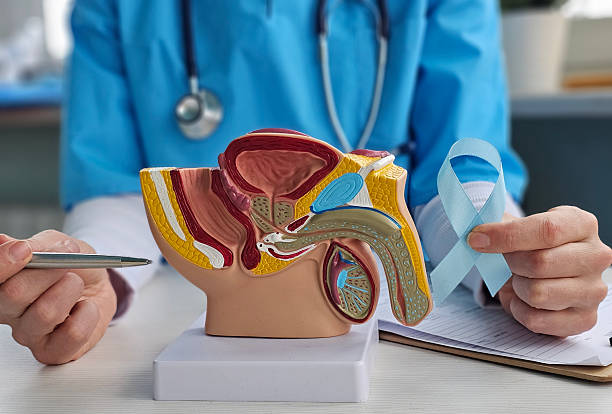 Prostate Problems in Men