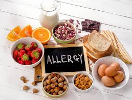 What Is a Food Allergy? Causes, Symptoms, Diagnosis & What to Do Next
