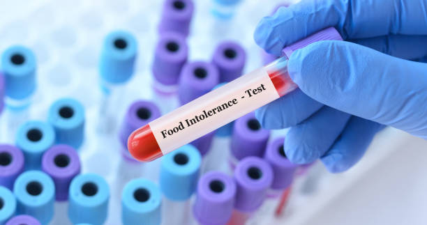 217-Parameter Food Intolerance Test