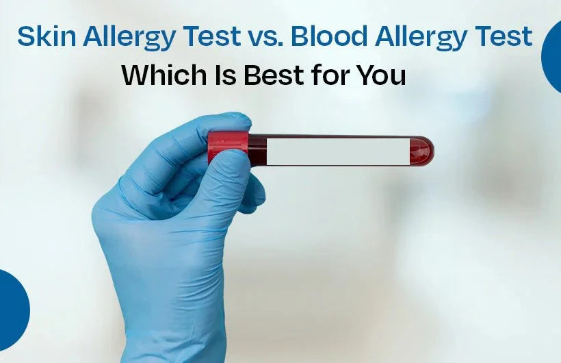 IgE Blood Test vs. Skin Prick Test: Which Allergy Test Is More Accurate & Better for You?