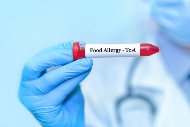 How Accurate Is an IgE Food Allergy Blood Test? 