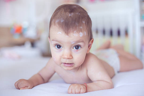 Dairy Allergy Symptoms in Babies & Adults
