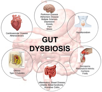 Gut Dysbiosis and Metabolism: How Gut Microbiome Imbalance Causes Hidden Weight Gain