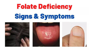 Folate Deficiency: Symptoms, Health Risks, Causes, and Testing Options