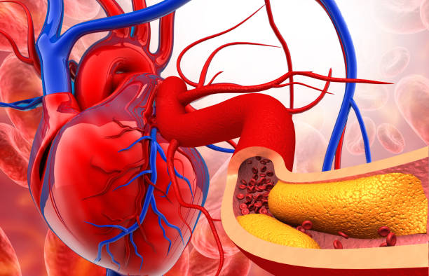 High Cholesterol & Blood Pressure