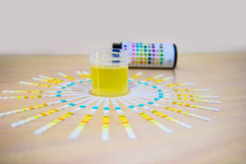 Glucose in Urine | urine sugar levels 