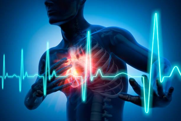 Can an ECG Test Predict a Heart Attack? 