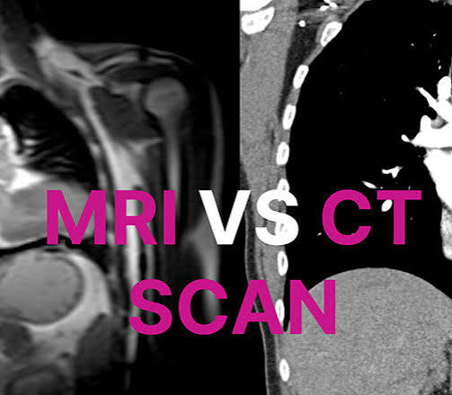 CT Scan vs MRI: Key Differences, Which Is Better, Safer & More Accurate for You?