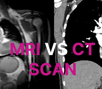 CT Scan vs MRI: Key Differences, Which Is Better, Safer & More Accurate for You?