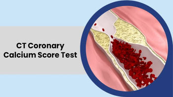 CT Coronary Calcium Score Explained: A Complete Guide to Your Results
