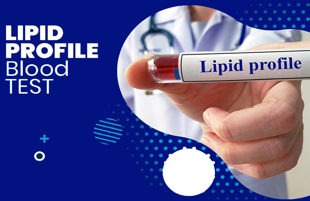 What is a Lipid Test? What's the Lipid Profile Test Normal Range?