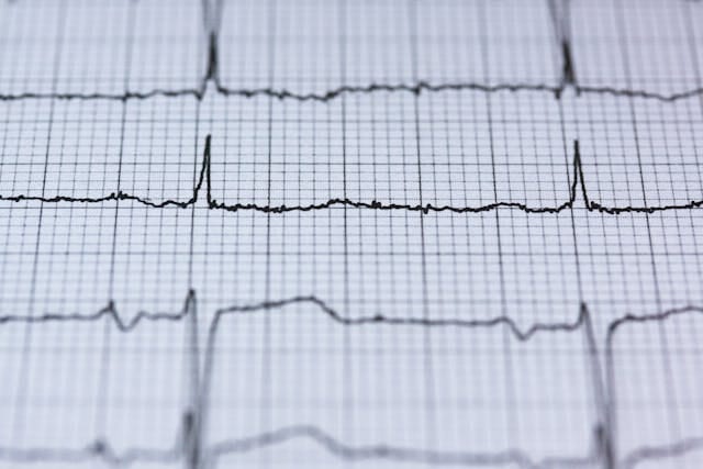 What is a dangerous heart rate? How do I manage heart rate?