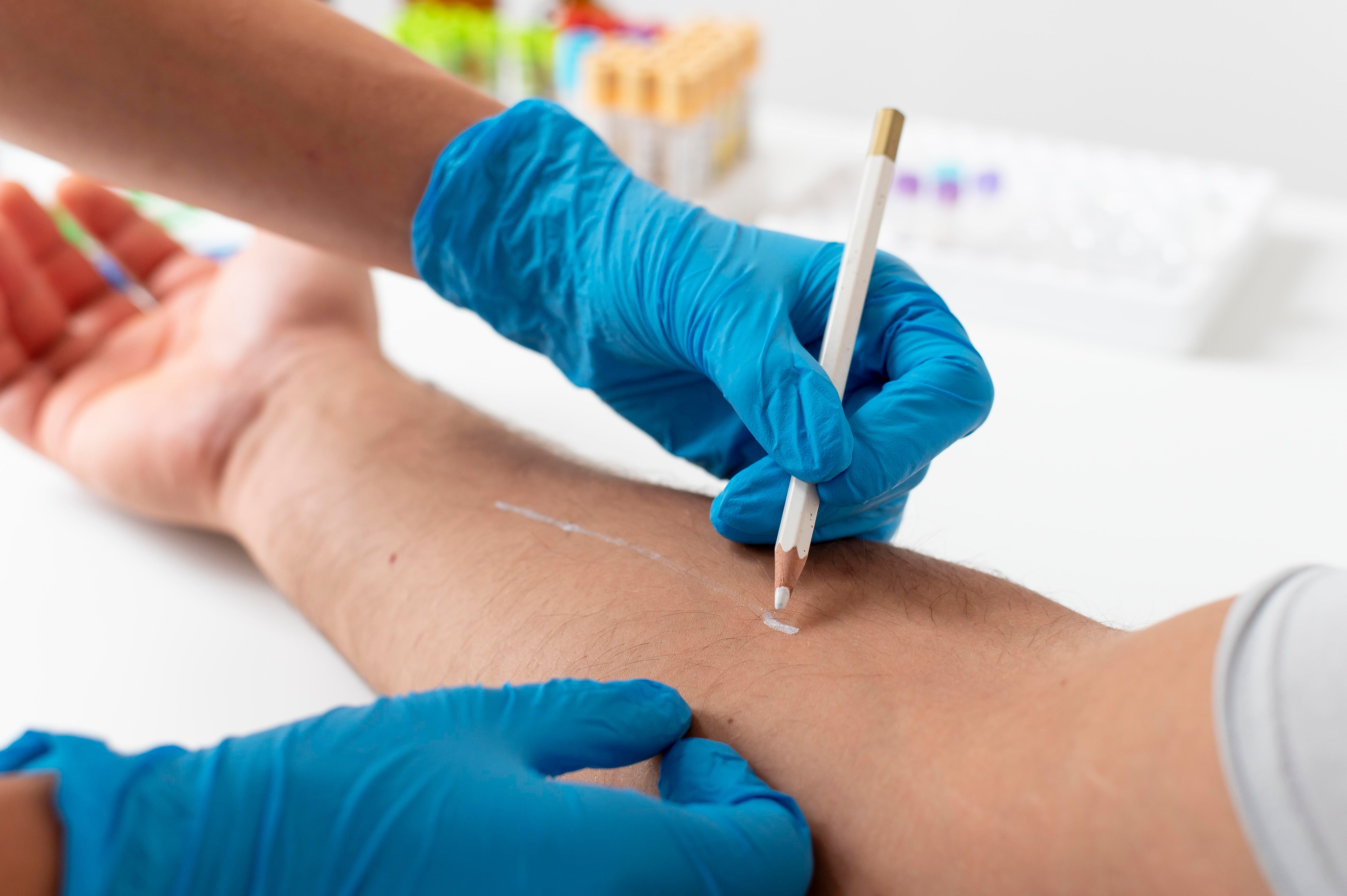 Mantoux Test | Tuberculin Skin Test |  Latent Tuberculin Infection |