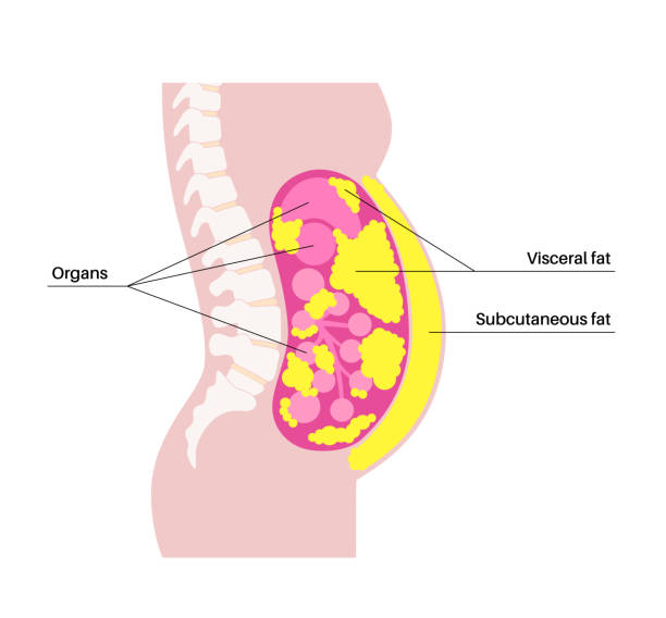 Visceral Fat  Subcutaneous fat | 
